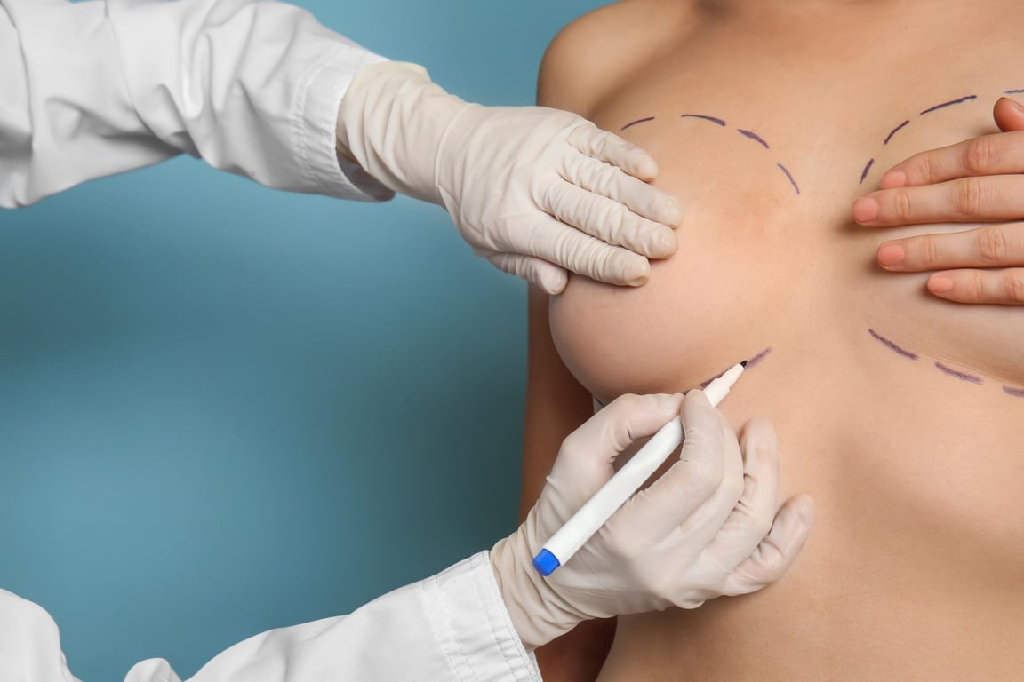 Doctor Drawing Marks on Female Breast before Cosmetic Surgery Operation against Color Background